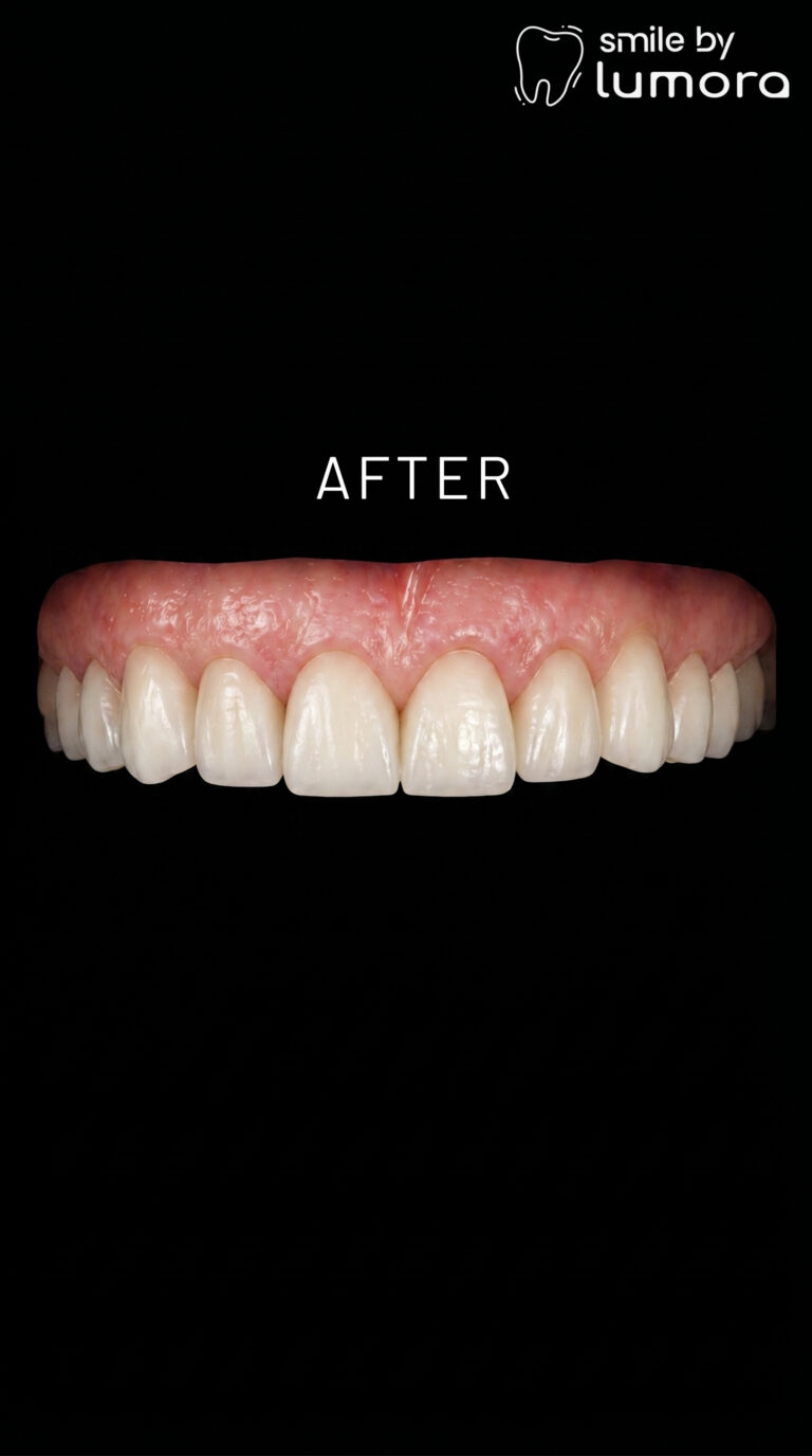 25.04.2026