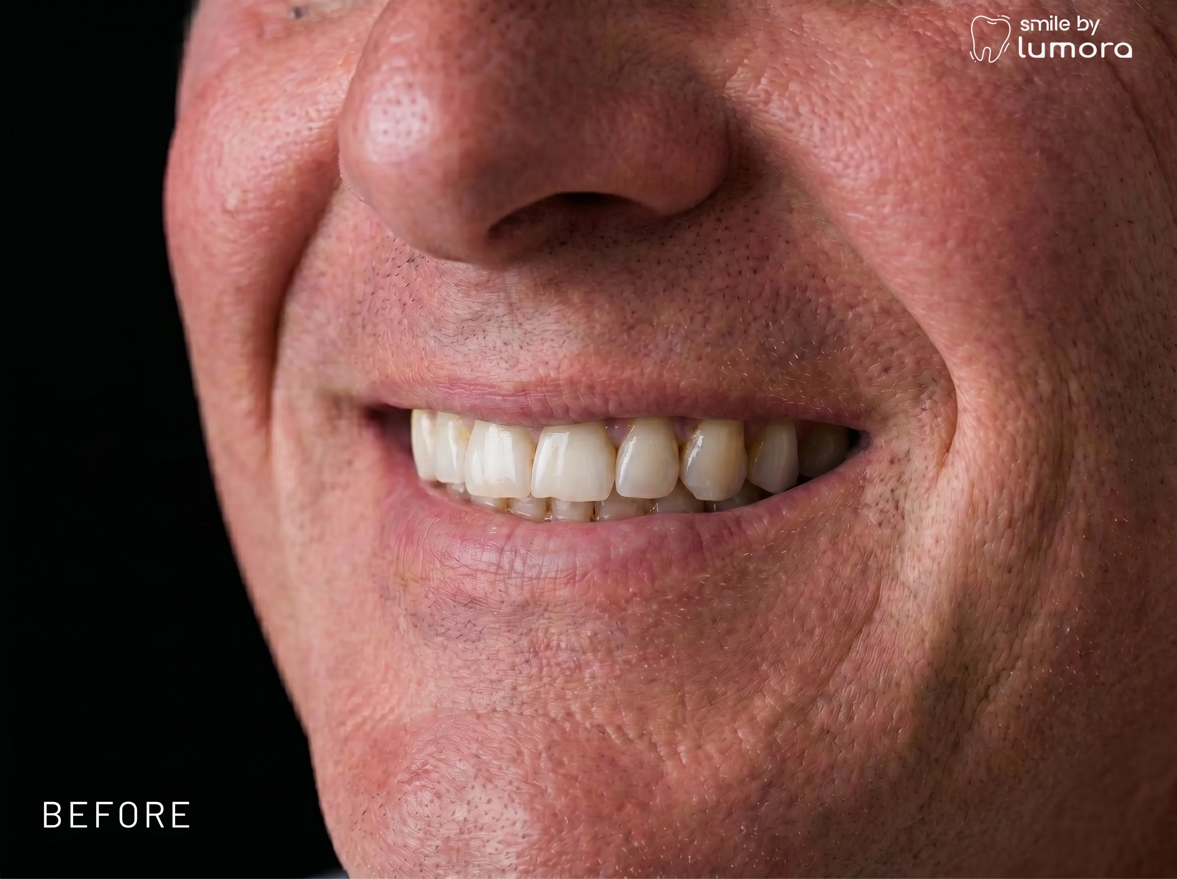 Dental technology